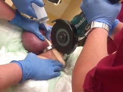 Cock ring surgery